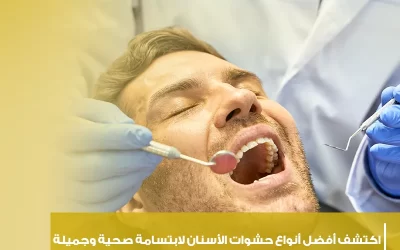 اكتشف أفضل انواع حشوات الأسنان لابتسامة صحية وجميلة