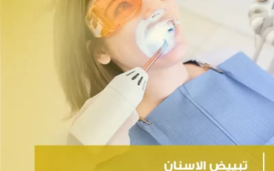 تبييض الاسنان (الطرق والمنتجات الفعالة)