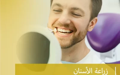 زراعة الأسنان (استعادة الابتسامة الجميلة والوظيفة الطبيعية)