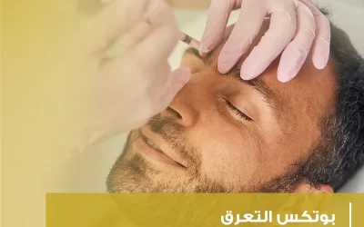 في فصل الصيف بوتوكس ازالة العرق هل هو فعال؟