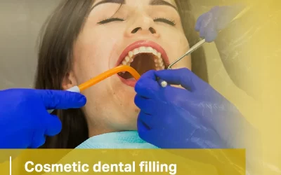 Cosmetic dental filling