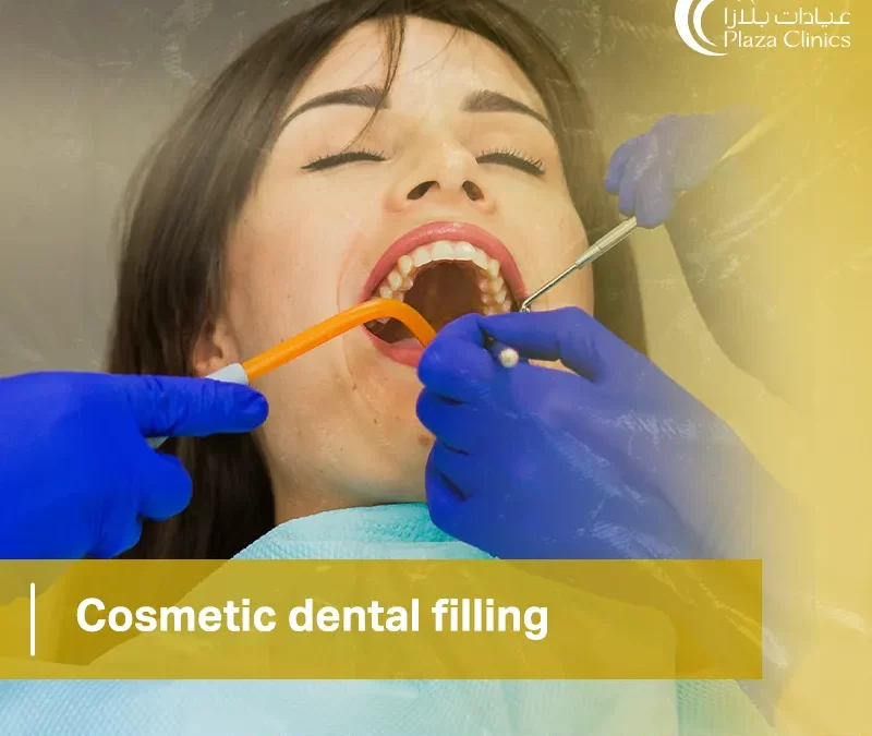 Cosmetic dental filling