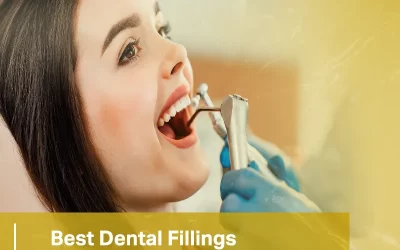 Best Dental Fillings