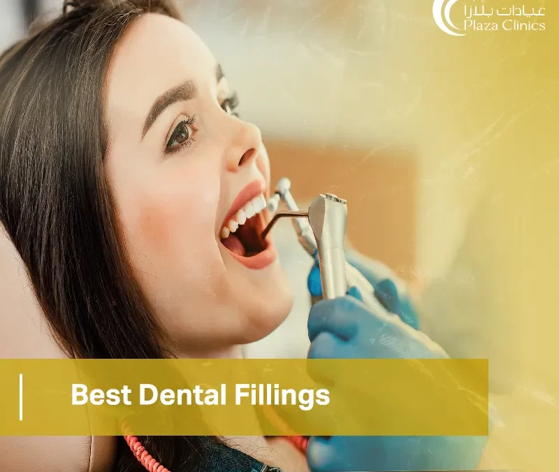 Best Dental Fillings