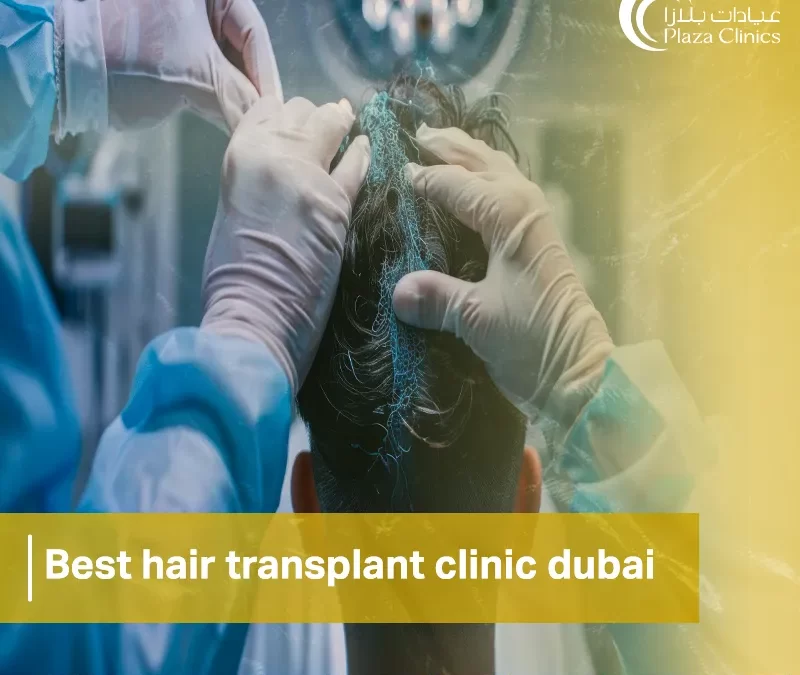 best hair transplant clinic dubai