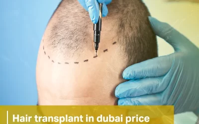 hair transplant in dubai price