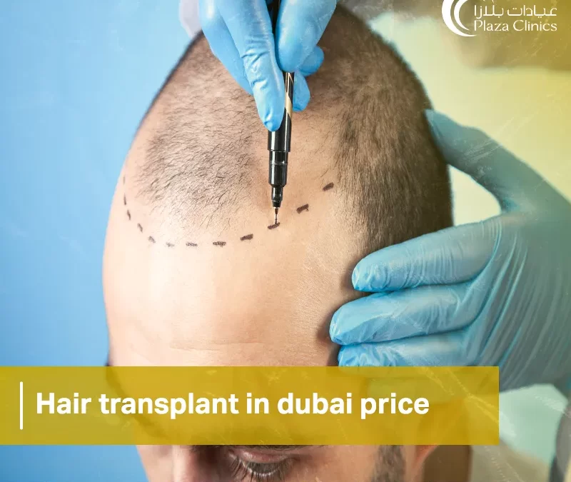 hair transplant in dubai price