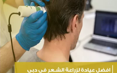 افضل عيادة لزراعة الشعر في دبي (سر الجمال والشعر الكثيف بانتظارك)