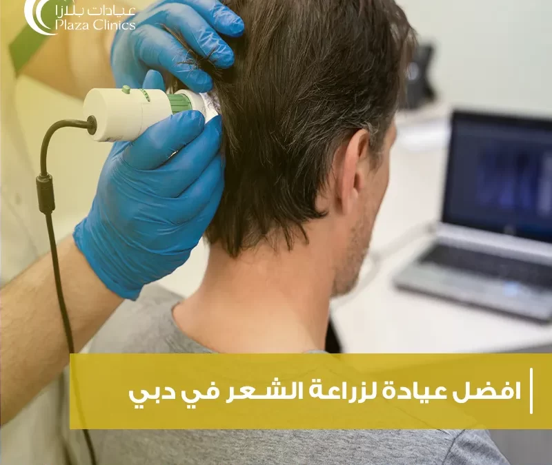 افضل عيادة لزراعة الشعر في دبي